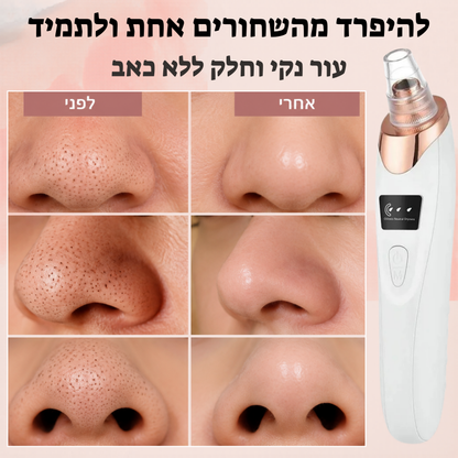 מכשיר להסרת שחורים