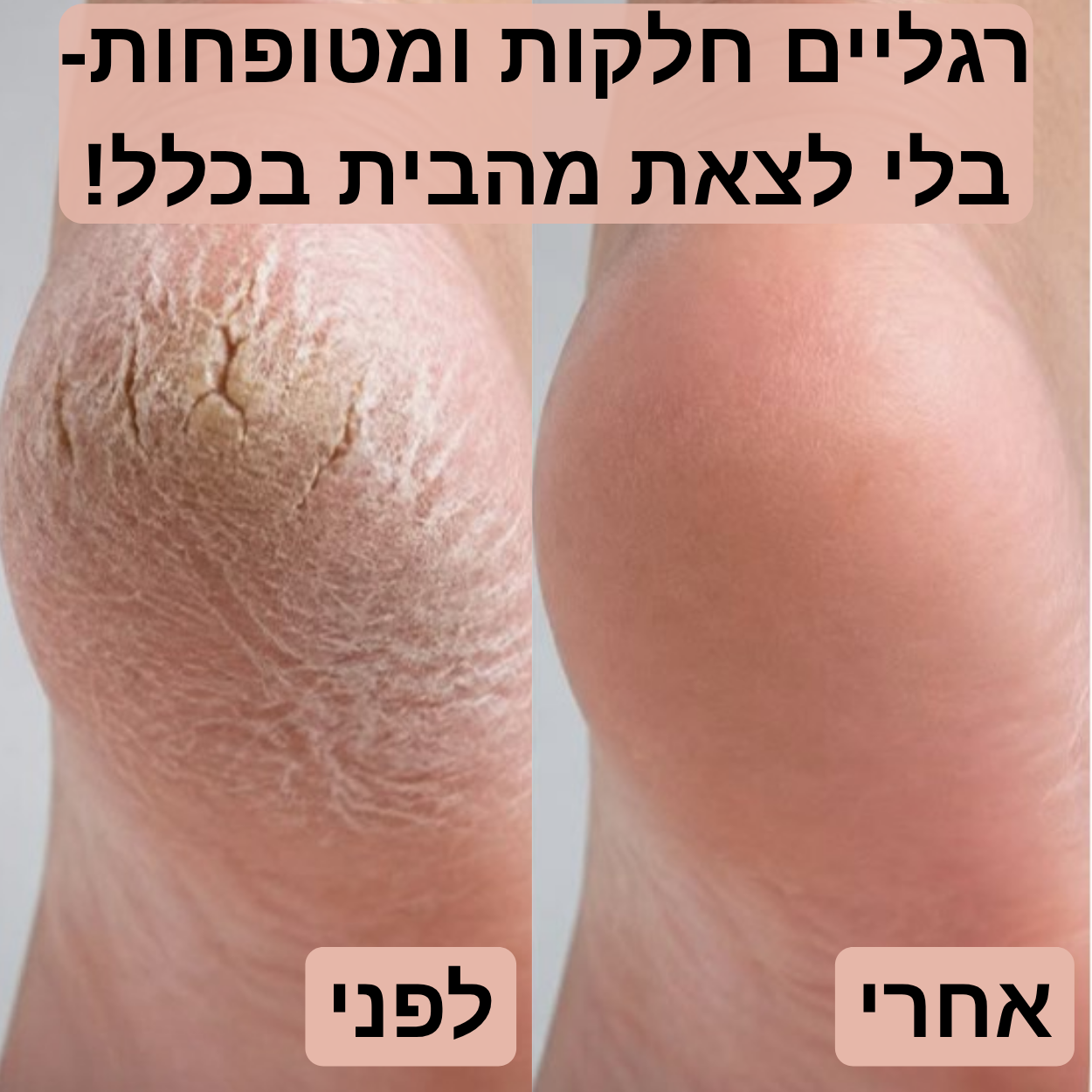 מכשיר פדיקור חשמלי להסרת עור קשה