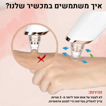 מכשיר להסרת שחורים