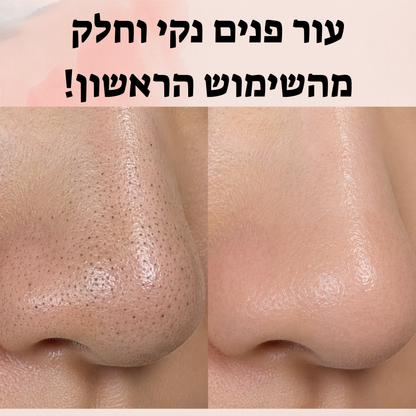 מכשיר להסרת שחורים