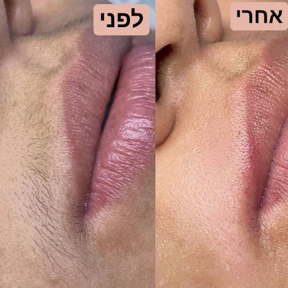 מכשיר להסרת השיער בפנים