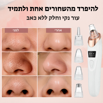 מכשיר להסרת שחורים