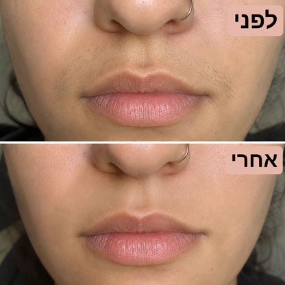 מכשיר להסרת השיער בפנים